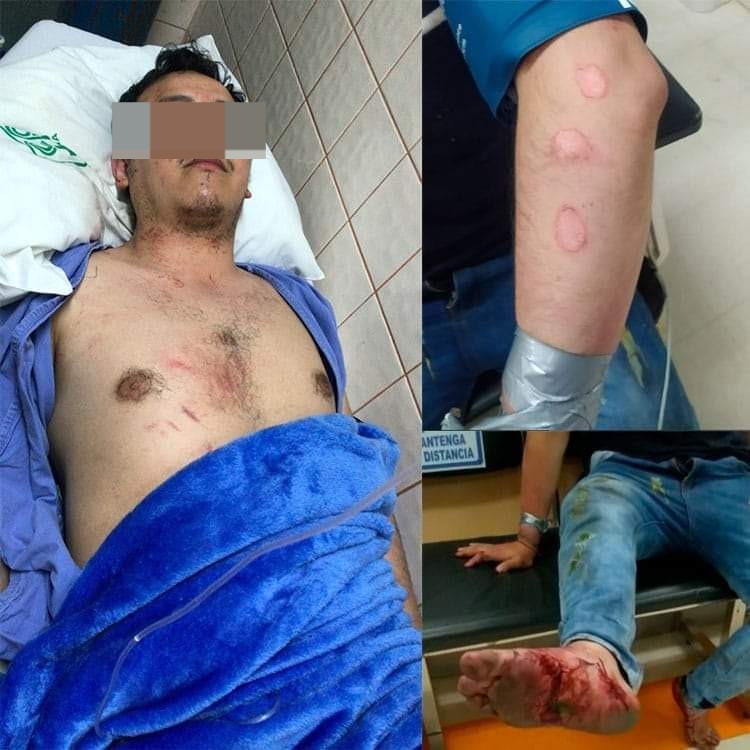 Abogado que fue torturado por miembros de la UJC tiene lesiones físicas y psicológicas