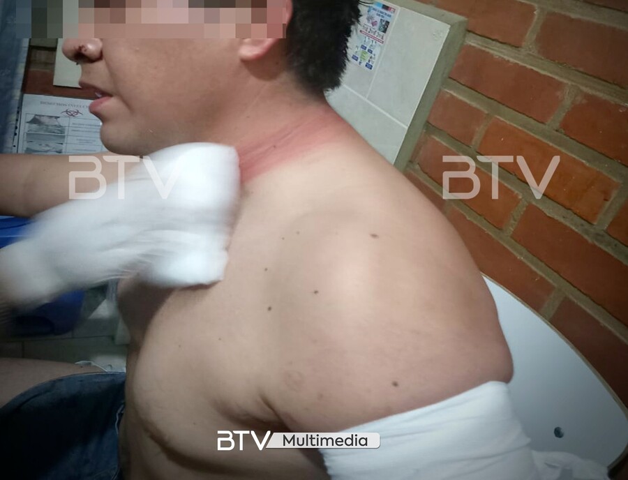 Evistas atacan a un médico en Pocona cuando salía a buscar comida