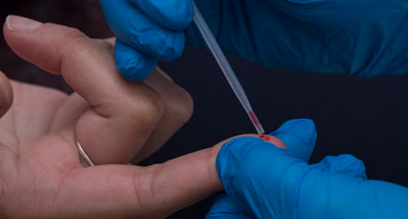 Riberalta registra 69 casos diagnosticados con VIH en lo que va de 2025