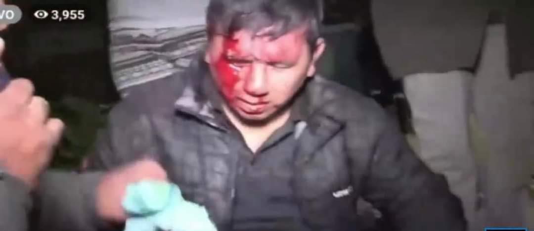 Viceministra expresa su solidaridad a periodista agredido e informa que se inició una investigación