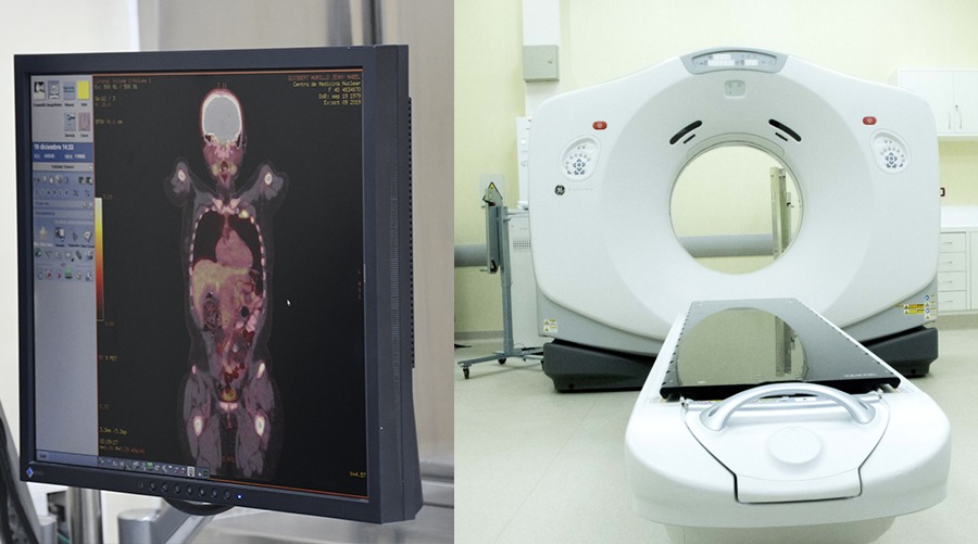 Red de Centros de Medicina Nuclear y Radioterapia beneficiará a pacientes con cáncer desde marzo