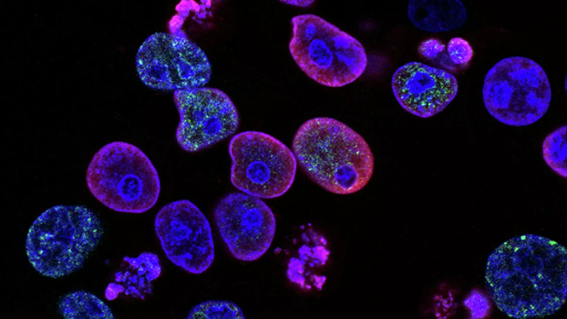 Rusia y Argentina planean realizar investigaciones para la detección precoz del cáncer