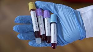 Anuncian pronto análisis de secuenciación genética de variantes de COVID-19 en Bolivia