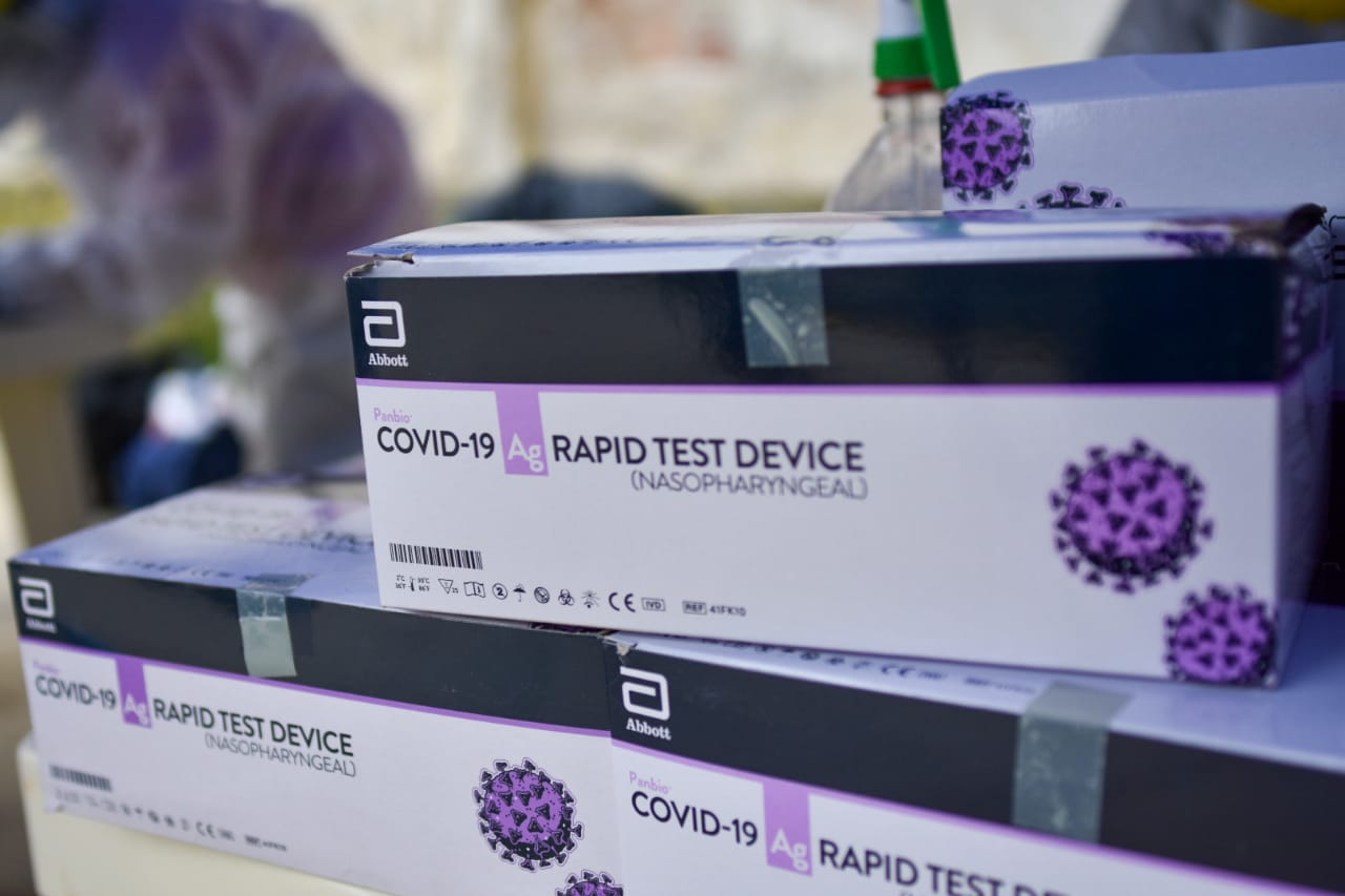 COVID-19: pruebas de antígenos beneficiarán a mujeres gestantes y pacientes que requieran cirugías