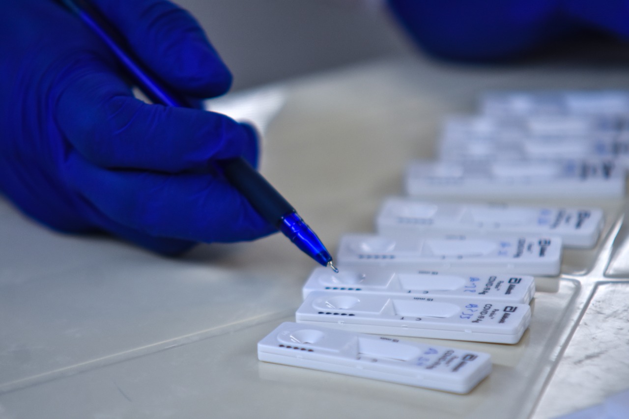 Santa Cruz inician distribución de 51.500 pruebas de antígeno nasal entregadas por el Gobierno